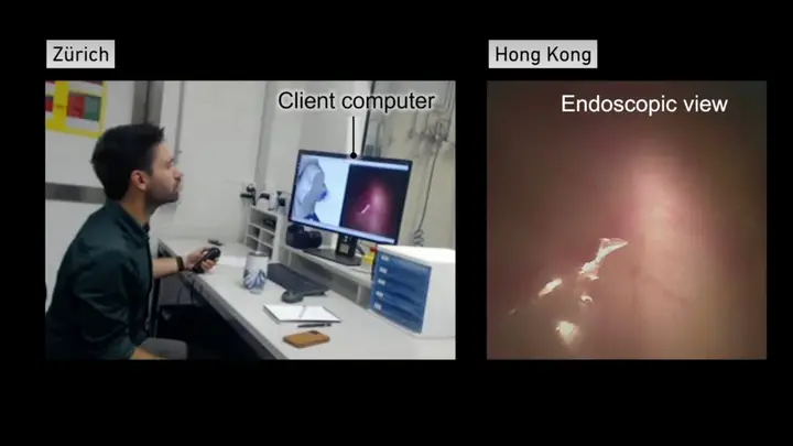 Surgeons use PlayStation controller to perform endoscopy 6,000 miles away – good job the PlayStation Network was still up at that point